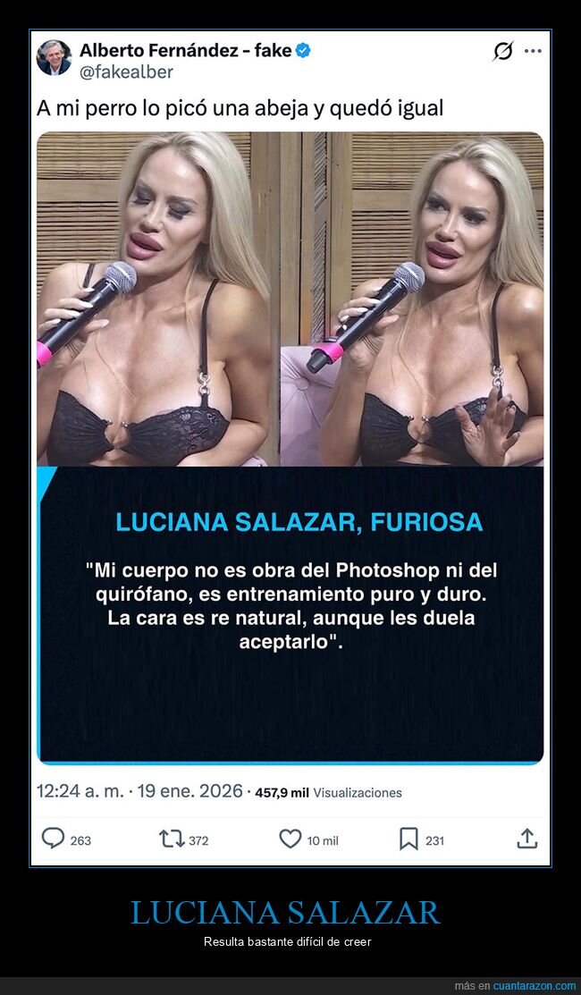 cirug&iacute;as,luciana salazar