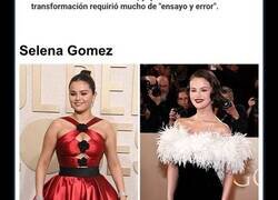 Enlace a Celebridades que perdieron peso de forma preocupante