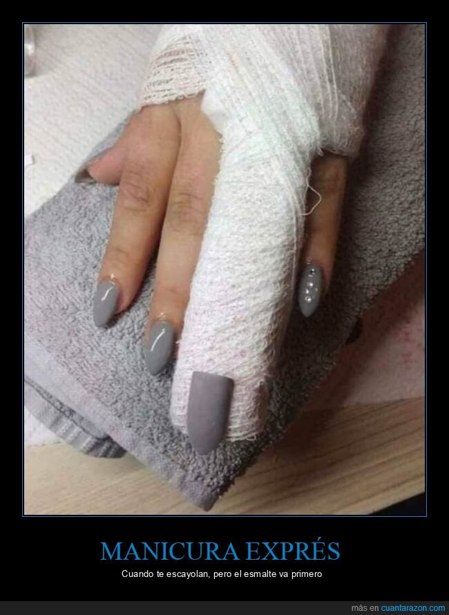 escayola,manicura,u&ntilde;as,accidente,prioridades