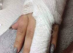 Enlace a Me escayolan, pero las uñas no se negocian