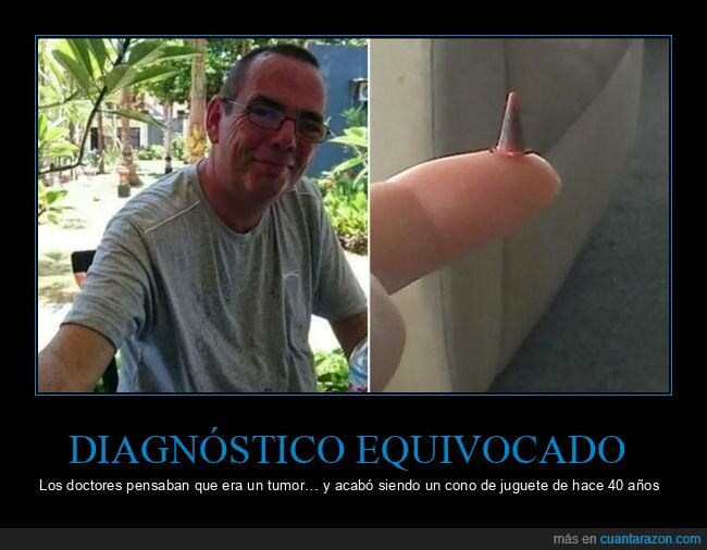 cirug&iacute;a,pulm&oacute;n,juguete,cono,diagn&oacute;stico