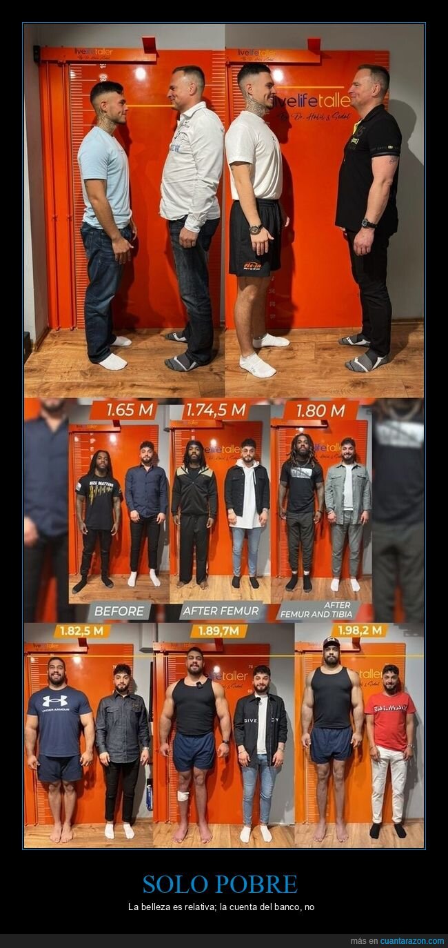 altura,dinero,comparaci&oacute;n,apariencia,cirug&iacute;a