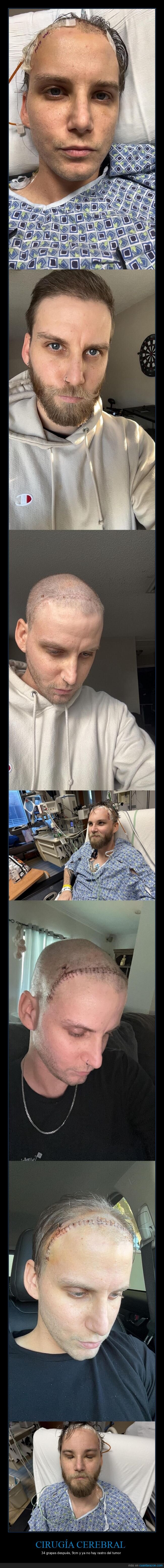 cirug&iacute;a,recuperaci&oacute;n,grapas,hospital,supervivencia