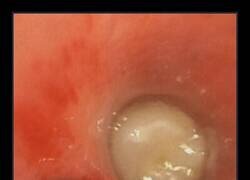 Enlace a Algo dentro de ti falla 