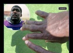 Enlace a Los dedos de un jugador de la NFL que estuvo jugando durante 14 temporadas