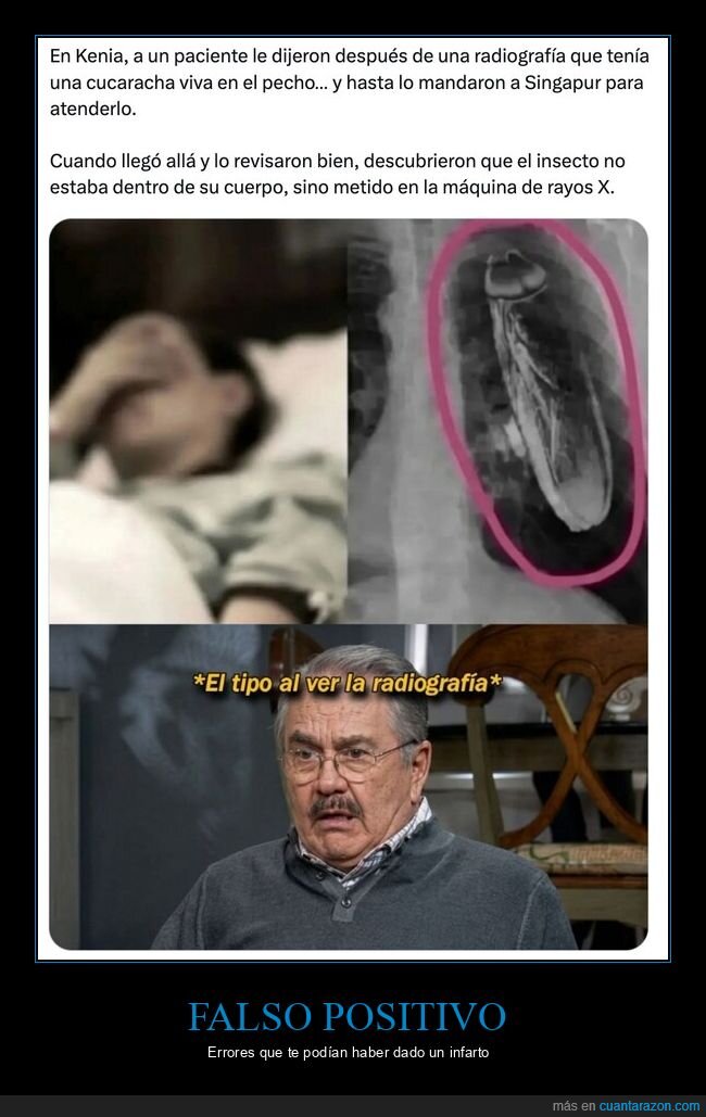 radiografia,cucaracha,hospital,diagnostico,viaje