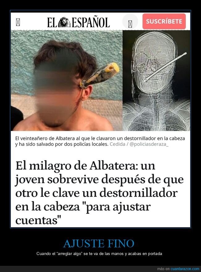 destornillador,agresion,radiografia,suceso,portada