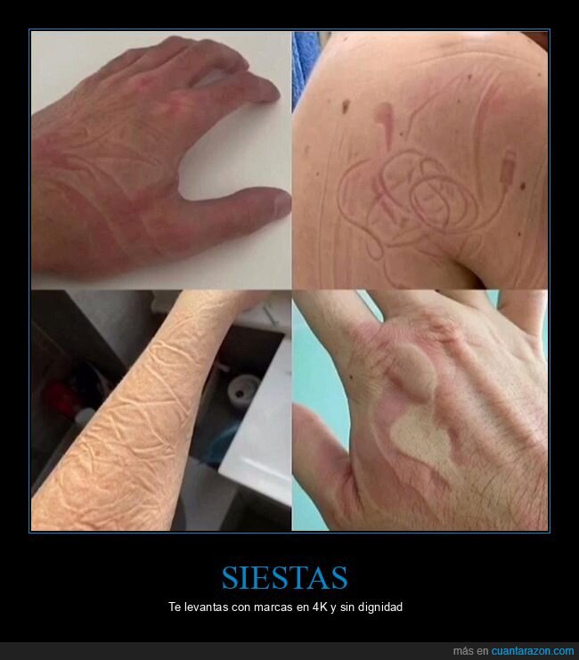 siesta,marcas,arrugas,almohada,descanso