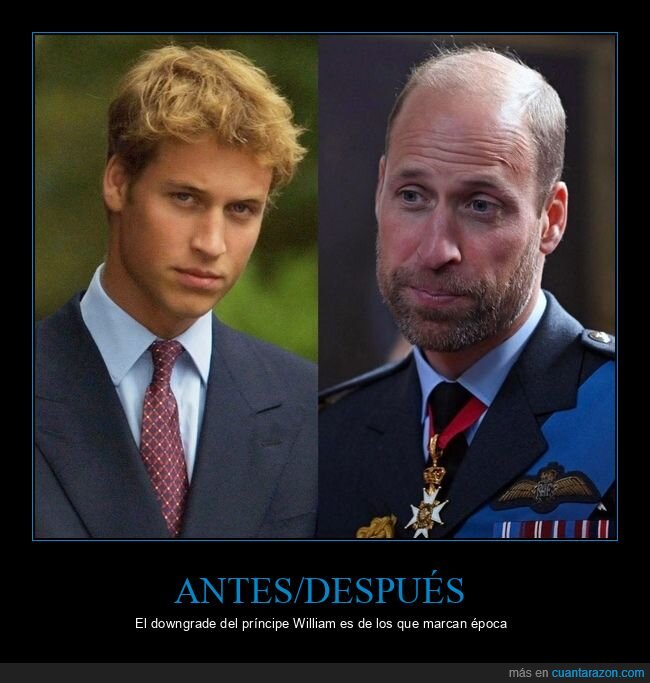 antes,despues,edad,cambio,calvicie,guillermo,gales,principe