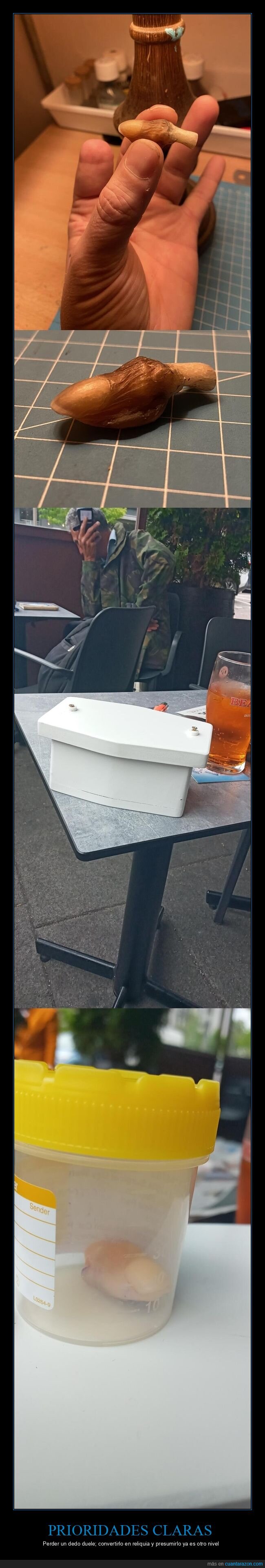 amp taci&oacute;n,dedo,momificaci&oacute;n,reliquia,absurdo