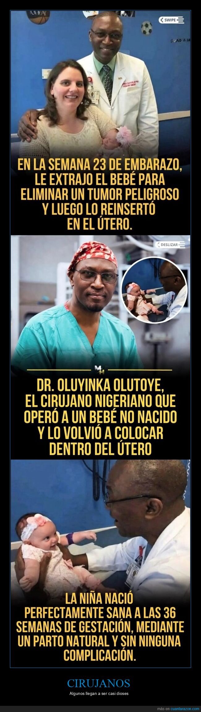 cirug&iacute;a,beb&eacute;,m&eacute;dico,milagro,oluyinka olutoye