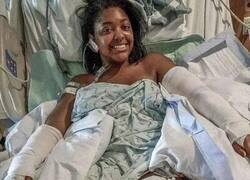 Enlace a Una mujer recibió 40 mordeduras para salvar a los niños del ataque de un perro agresivo