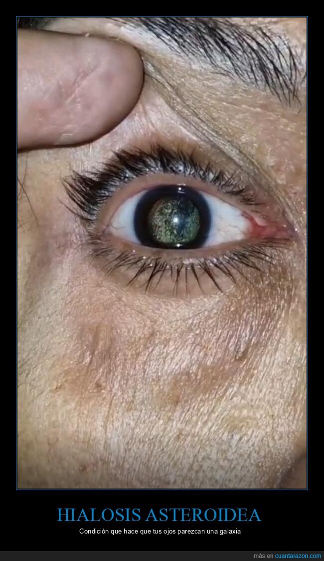 ojo,galaxia,pupila,astroides,oftalmologia