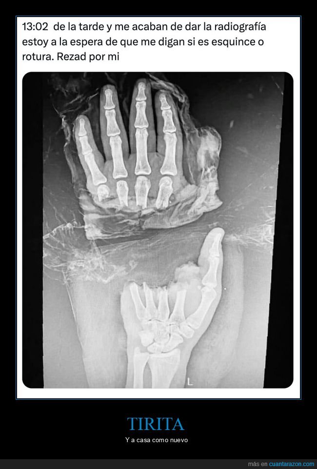 radiograf&iacute;a,mano,urgencias,espera,lesi&oacute;n