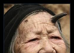 Enlace a Los cuernos cutáneos son tumores cutáneos queratósicos inusuales que tienen la apariencia de cuernos, o a veces de madera o coral