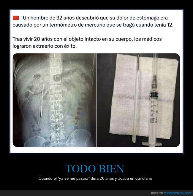 term&oacute;metro,radiograf&iacute;a,est&oacute;mago,m&eacute;dicos,extracci&oacute;n