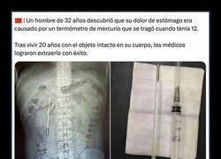 Enlace a Igual tiene super-poderes y no lo sabe