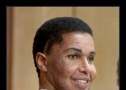 Enlace a Oneal Ron Morris, una falsa médica fue arrestada por inyectar cemento y superglue en cirugías plásticas, desfigurando a pacientes y a sí misma