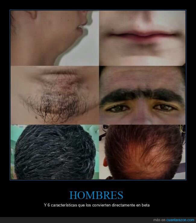 pubertad,barba,calvicie,bigote,inseguridad