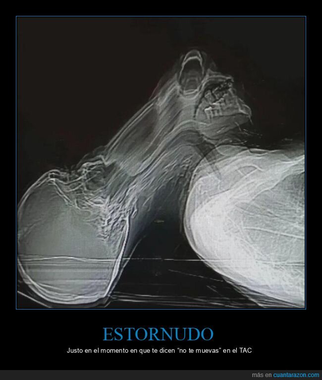 tac,estornudo,radiografia,hospital,caos