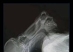 Enlace a Resultado de un estornudo durante una tomografía computarizada