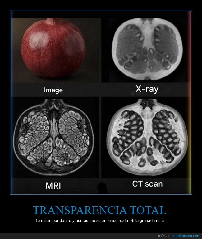 granada,radiograf&iacute;a,resonancia,tomograf&iacute;a,ciencia