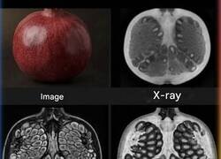 Enlace a Una granada vista a través de radiografías, tomografías computarizadas y resonancias magnéticas
