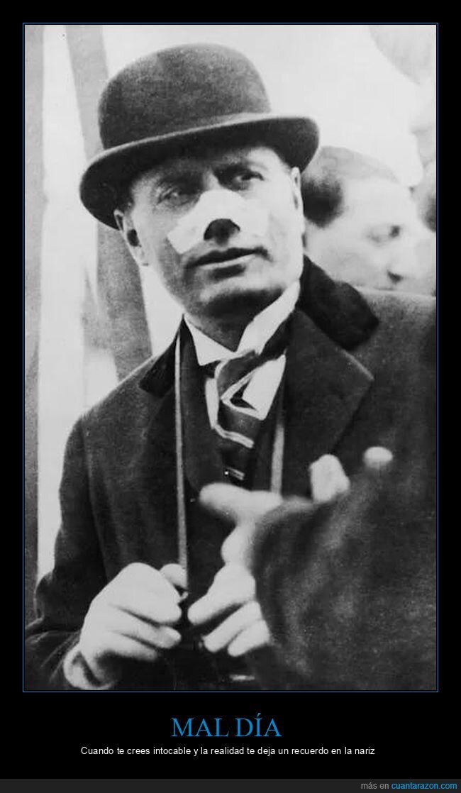 Mussolini,atentado,venda,nariz,historia