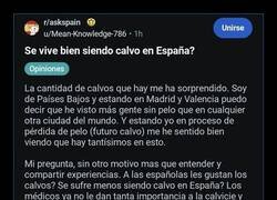 Enlace a En España no eres calvo, eres mayoría