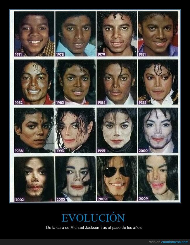 MichaelJackson,evoluci&oacute;n,cambios,cirug&iacute;a,transformaci&oacute;n