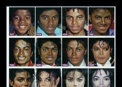 Enlace a El tío tuvo los santos coj*nes de decir que solo se había operado la nariz eh. Historia