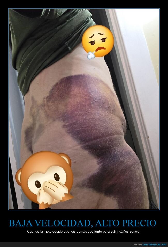 motocicleta,accidente,moratones,fracaso,consecuencias