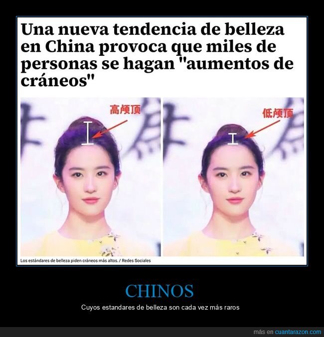 frente,cerebro,ampliaci&oacute;n