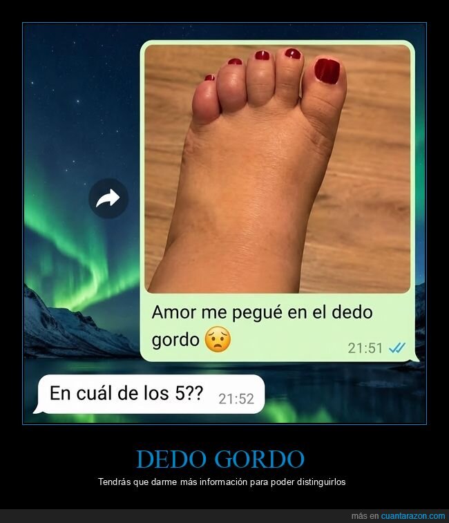 dedos,hinchaz&oacute;n,amor,relaciones,fracaso