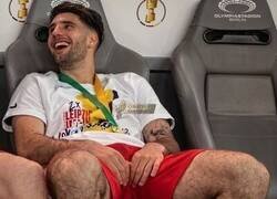 Enlace a Internet se llena de comentarios sobre estas fotos de Dominik Szoboszlai, uno de los pocos jugadores profesionales que no se depila las piernas