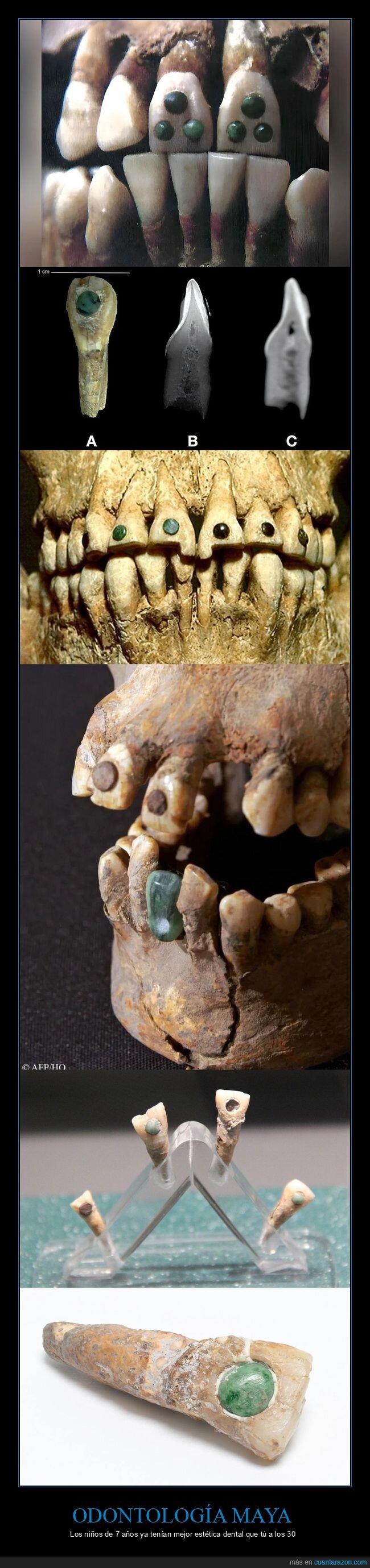 arqueolog&iacute;a,est&eacute;tica,antig&uuml;edad,dentadura,fracaso