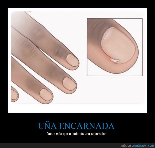 u&ntilde;a,dolor,separaci&oacute;n,sufrimiento,inevitable