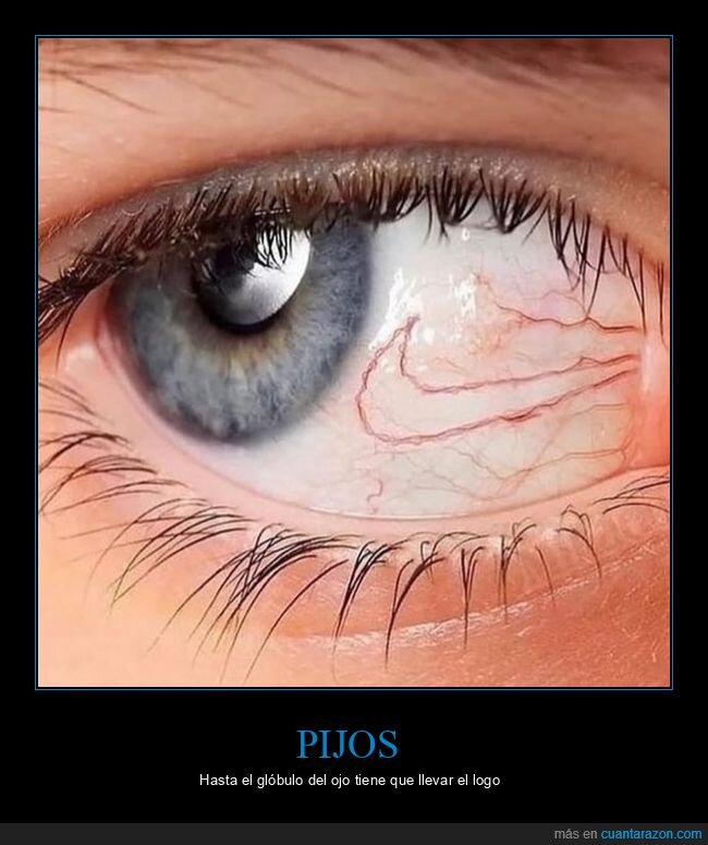 ojos,cansancio,belleza,realidad,filtros