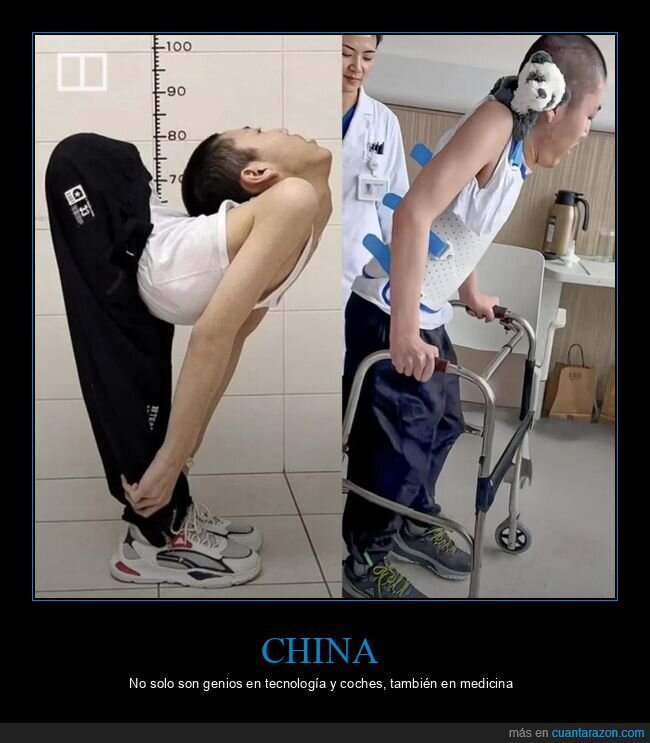 postura,flexibilidad,medicina,contorsi&oacute;n,r&eacute;cord
