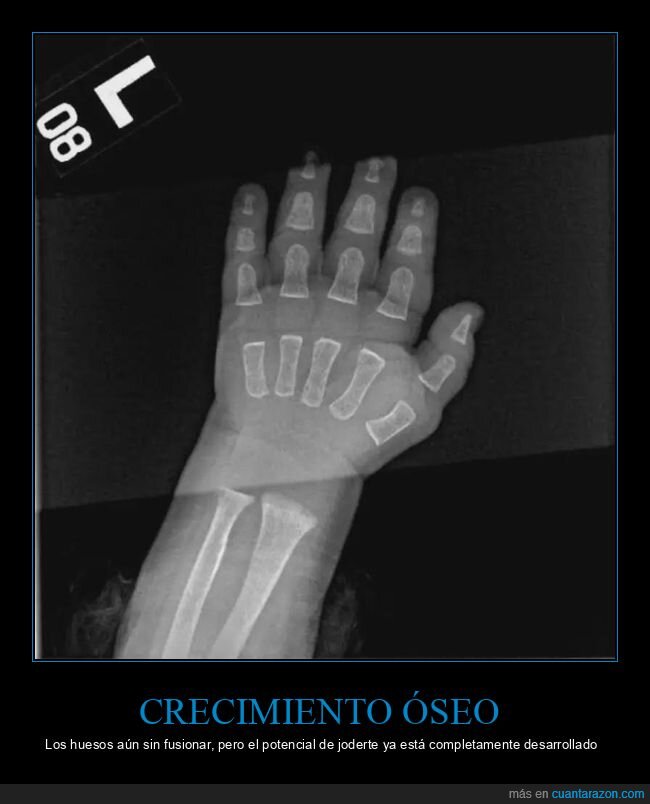 radiograf&iacute;a,beb&eacute;,destino,huesos,crecimiento