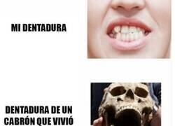 Enlace a Retroceso Dental Garantizado