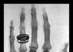 Enlace a Capturada por Wilhelm Conrad Röntgen. La persona que se sometió a la prueba fue su esposa, Anna Bertha Ludwig