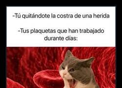Enlace a La venganza de la costra