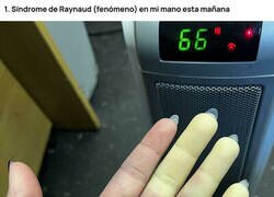 Enlace a Rasgos humanos poco comunes que hacen que nuestro cuerpo sea aún más random