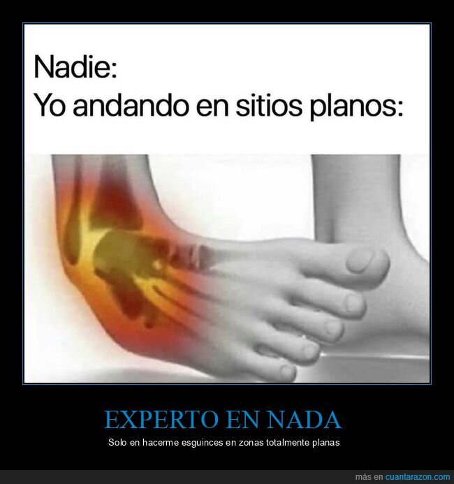 tobillos,equilibrio,fracaso,dolor,tropezar