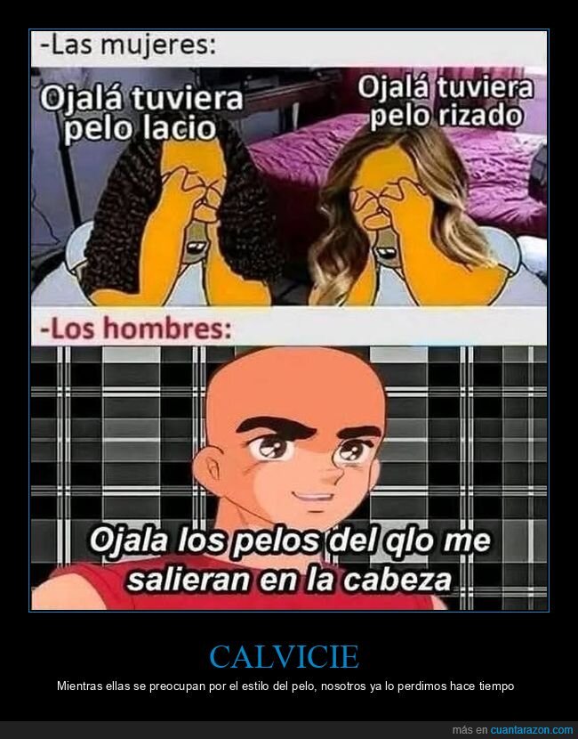 calvicie,diferencias,g&eacute;nero,cabello,relatable