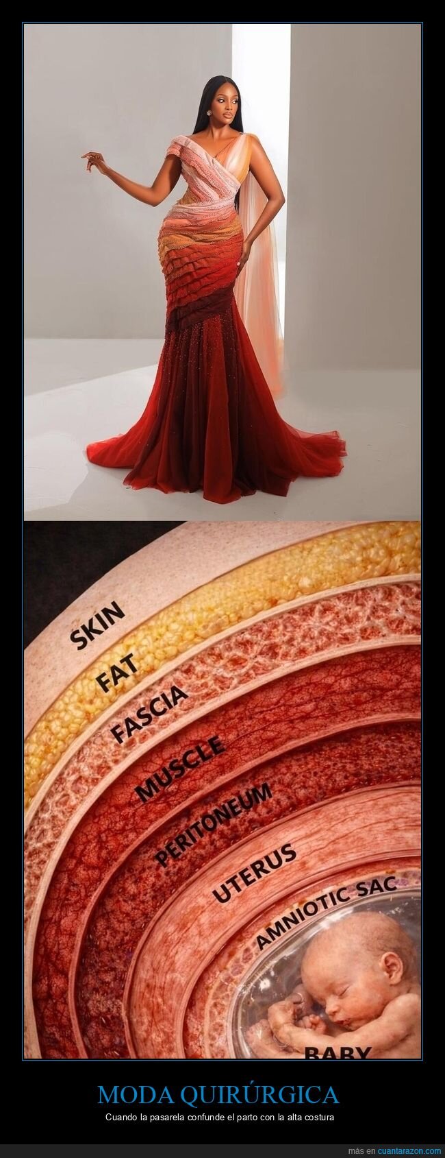 moda,absurdo,concurso,dise&ntilde;o,Uganda