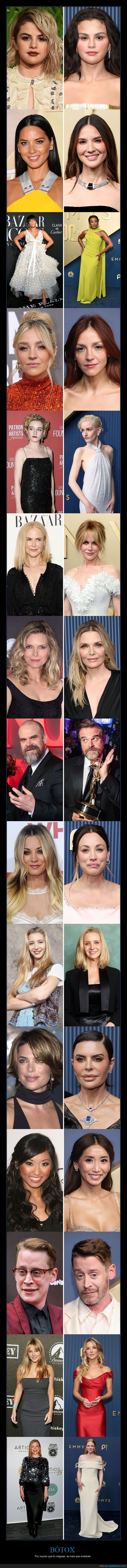 Hollywood,Emmy,cirug&iacute;a,belleza,famosos