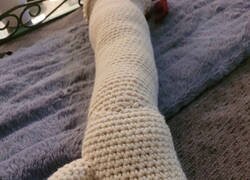 Enlace a Después de perder mi brazo derecho, mi primo pasó 48 horas tejiendo a crochet un nuevo brazo para mí