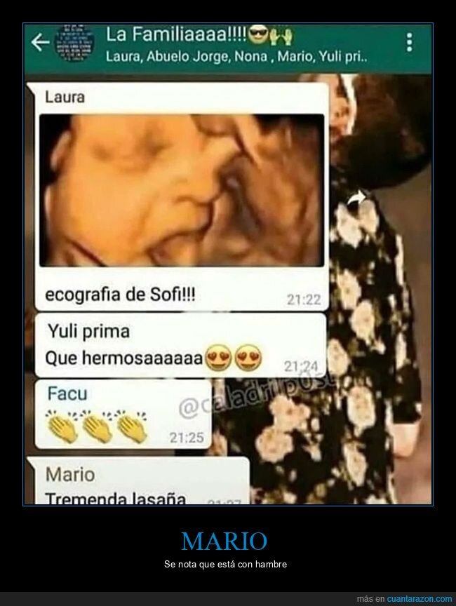 ecografia,bebe,lasa&ntilde;a